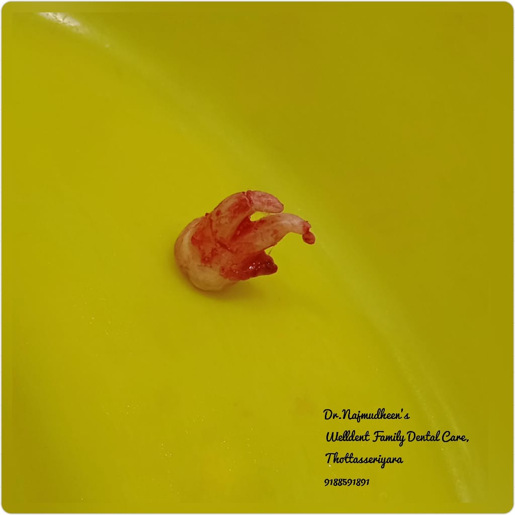 WellDent Family Dental Care