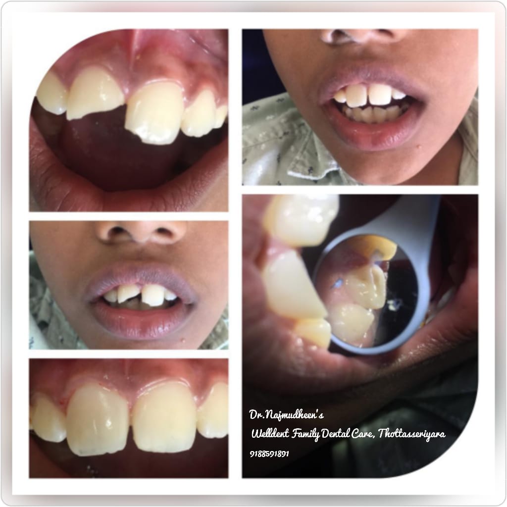 WellDent Family Dental Care