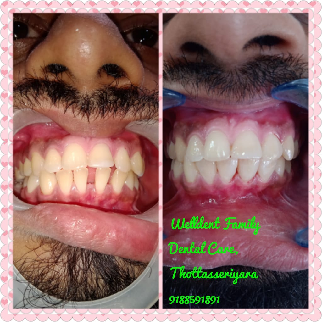WellDent Family Dental Care