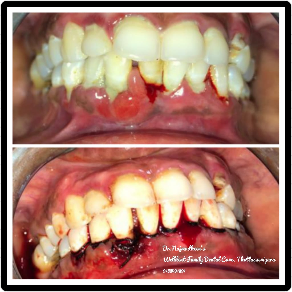 WellDent Family Dental Care