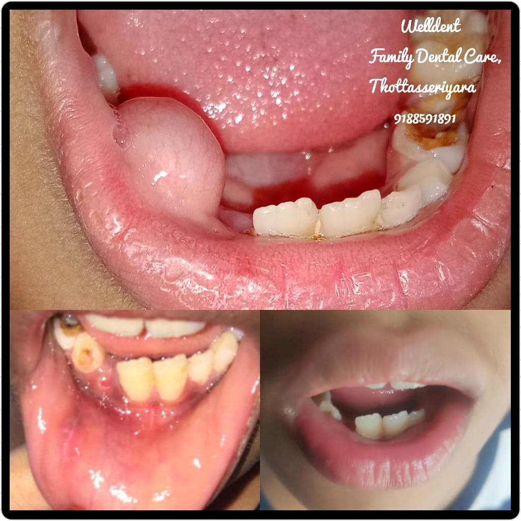 WellDent Family Dental Care