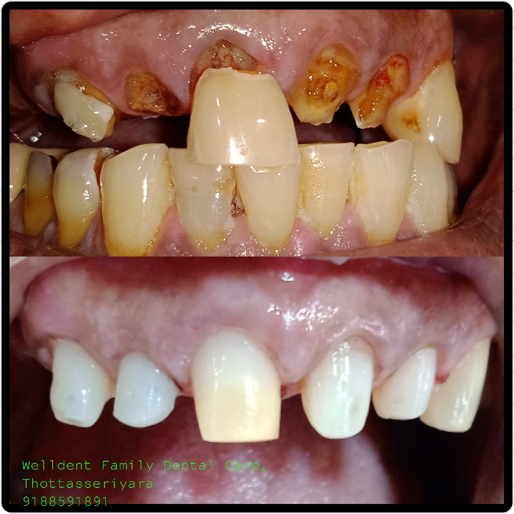 WellDent Family Dental Care